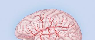 Дисциркуляторна енцефалопатія головного мозку - лікування і види терапії