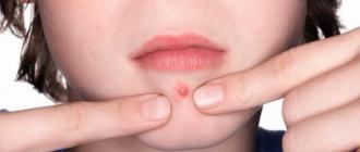 How to get rid of acne on the face quickly, folk remedies and pharmacy